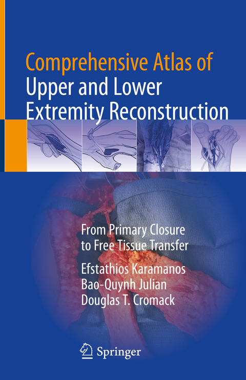 Comprehensive Atlas of Upper and Lower Extremity Reconstruction - Efstathios Karamanos, Bao-Quynh Julian, Douglas T. Cromack