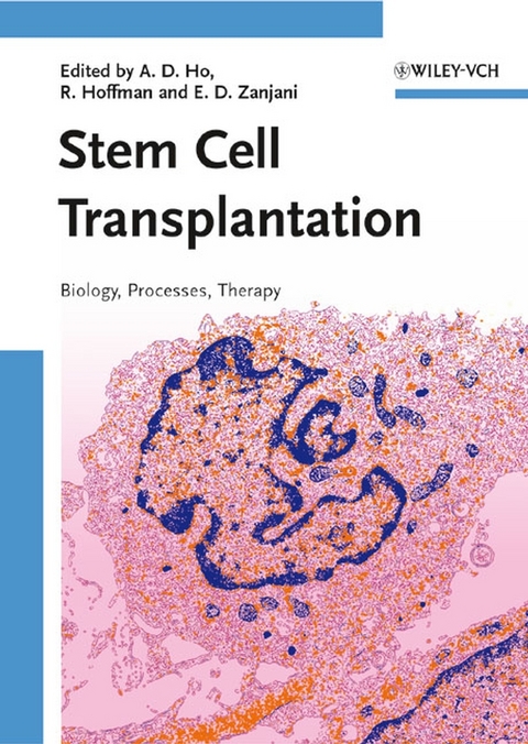 Stem Cell Transplantation - 