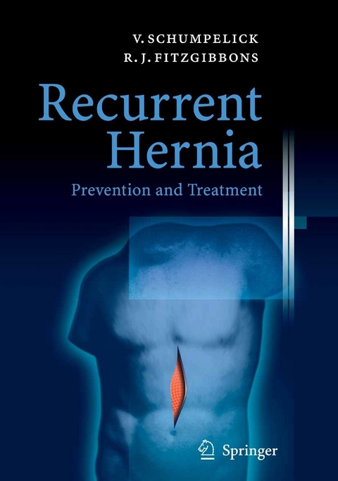 Recurrent Hernia -  Volker Schumpelick,  Robert J. Fitzgibbons