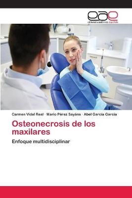 Osteonecrosis de los maxilares - Carmen Vidal Real, Mario Pérez Sayáns, Abel García García