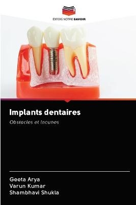 Implants dentaires - Geeta Arya, Varun Kumar, Shambhavi Shukla