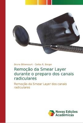 Remoção da Smear Layer durante o preparo dos canais radiculares - Bruna Bittencourt, Carlos R Berger