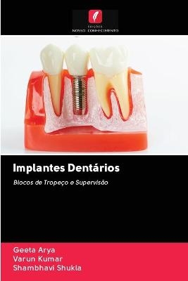 Implantes Dentários - Geeta Arya, Varun Kumar, Shambhavi Shukla