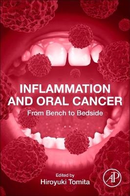 Inflammation and Oral Cancer - 