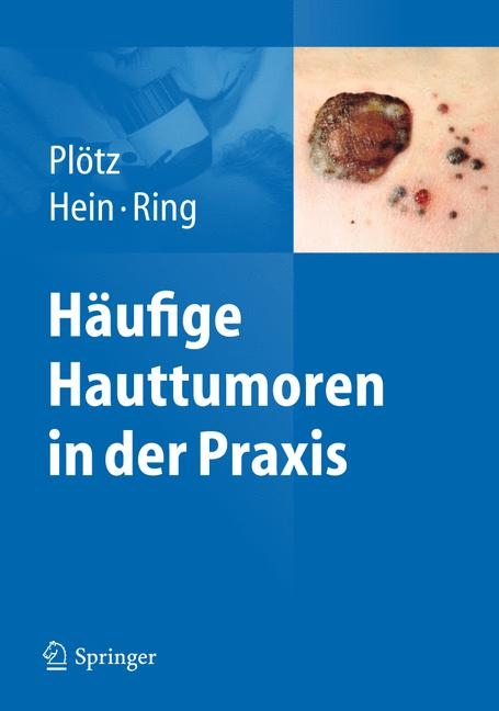 Häufige Hauttumoren in der Praxis - Sabine G. Plötz, Rüdiger Hein, Johannes Ring