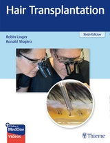 Hair Transplantation - Unger, Robin; Shapiro, Ronald