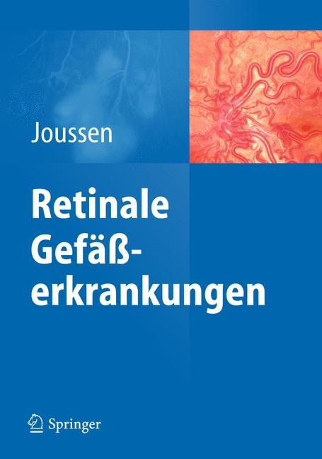 Retinale Gefäßerkrankungen - 