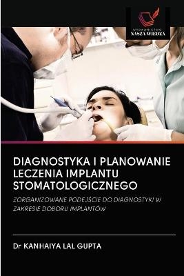 Diagnostyka I Planowanie Leczenia Implantu Stomatologicznego - Dr KANHAIYA LAL GUPTA