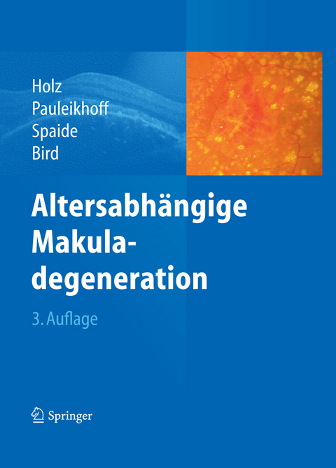 Altersabhängige Makuladegeneration - 