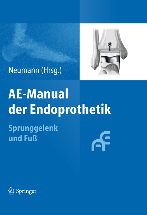 AE-Manual der Endoprothetik - 