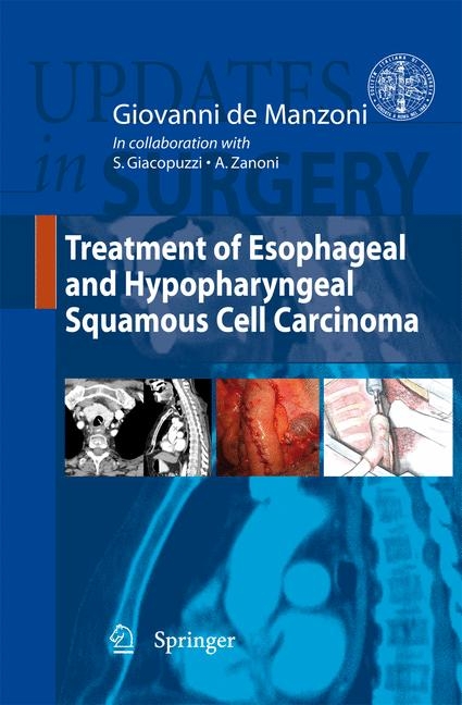 Treatment of Esophageal and Hypopharyngeal Squamous Cell Carcinoma - 