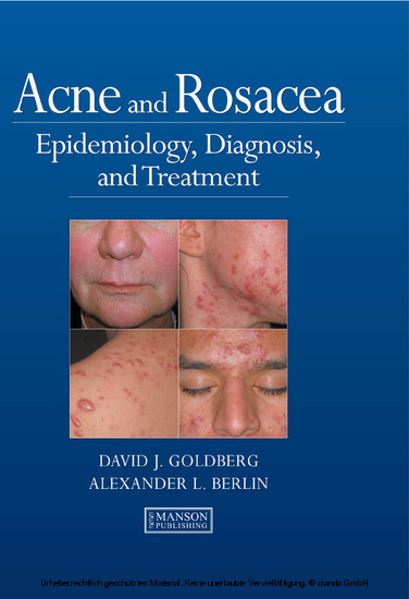 Acne and Rosacea -  Alexander Berlin,  David Goldberg