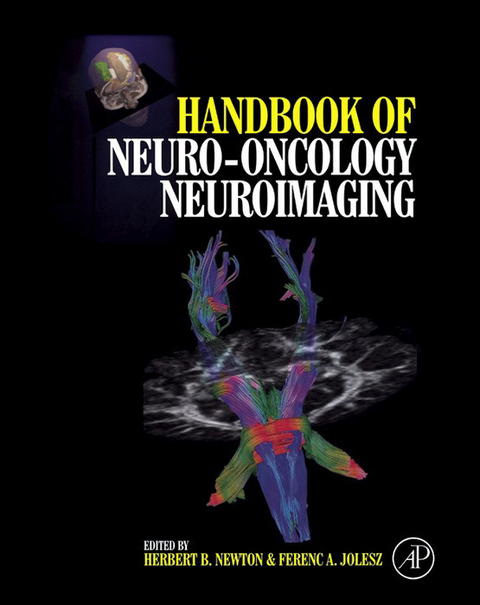 Handbook of Neuro-Oncology Neuroimaging - 