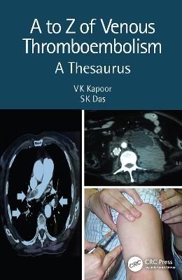 A to Z of Venous Thromboembolism - Vk Kapoor, SK Das