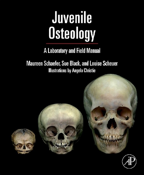 Juvenile Osteology -  Sue Black,  Maureen C. Schaefer,  Louise Scheuer