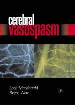 Cerebral Vasospasm -  R. Loch Macdonald,  Bruce Weir