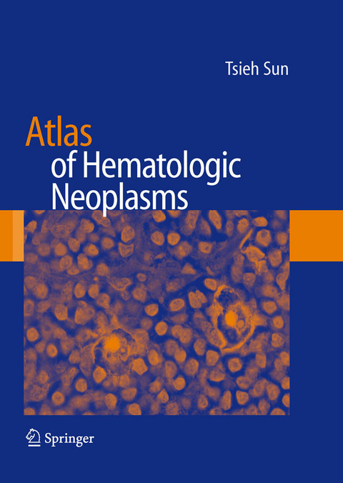 Atlas of Hematologic Neoplasms - Tsieh Sun