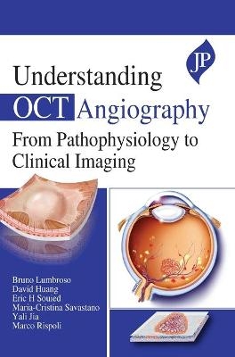 Understanding OCT Angiography - Bruno Lumbroso, David Huang, Eric H Souied, Cristina Maria Savastano, Yali Jia