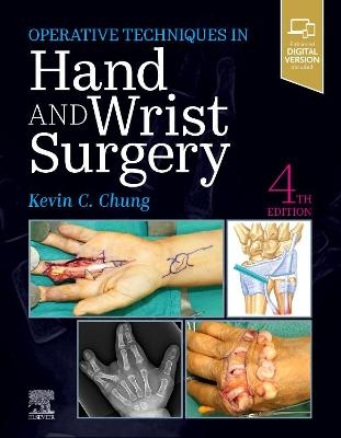 Operative Techniques: Hand and Wrist Surgery - Kevin C. Chung