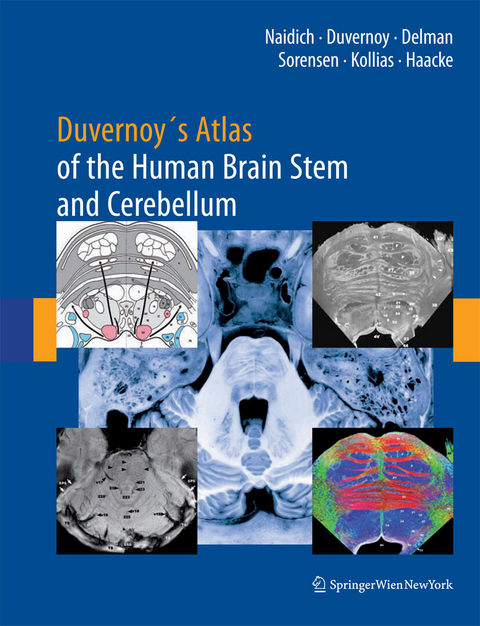 Duvernoy's Atlas of the Human Brain Stem and Cerebellum - Thomas P. Naidich, Henri M. Duvernoy, Bradley N. Delman, A. Gregory Sorensen, Spyros S. Kollias, E. Mark Haacke