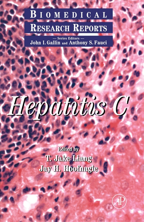 Hepatitis C - 