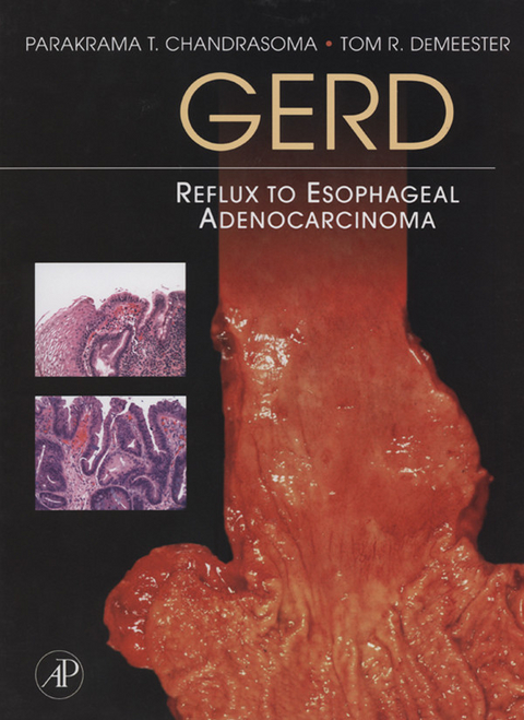 GERD -  Parakrama T. Chandrasoma,  Tom R. DeMeester