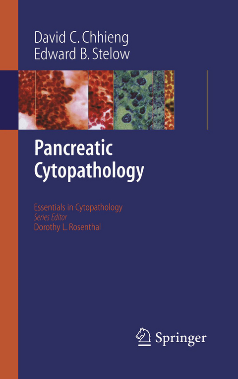 Pancreatic Cytopathology - David C. Chhieng, Edward B. Stelow