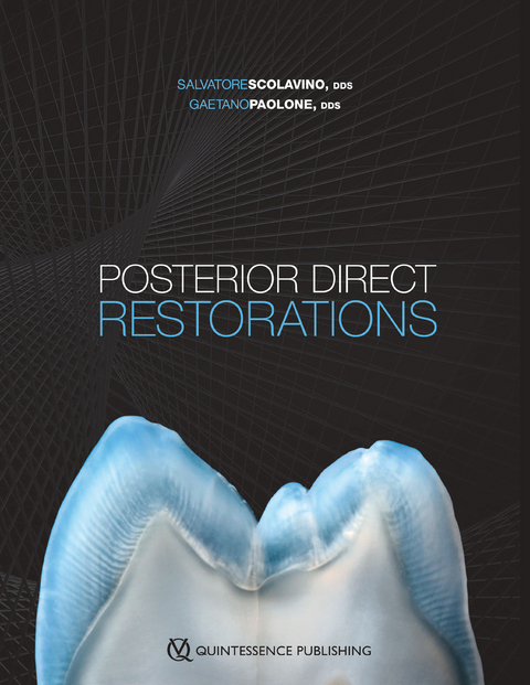 Posterior Direct Restorations - Salvatore Scolavino