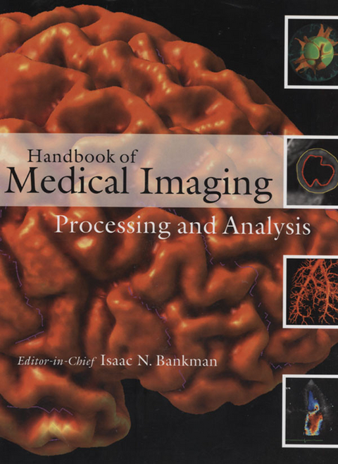 Handbook of Medical Imaging