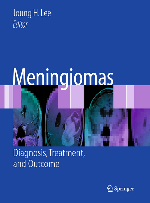 Meningiomas - 