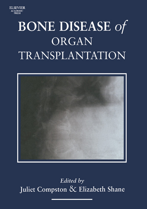 Bone Disease of Organ Transplantation - 