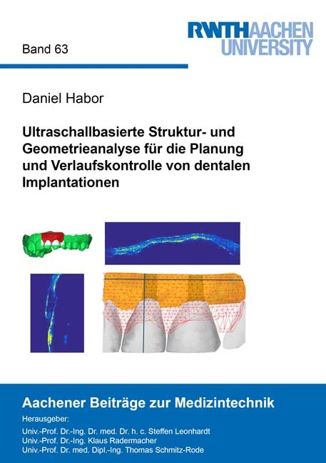 Ultraschallbasierte Struktur- und Geometrieanalyse für die Planung und Verlaufskontrolle von dentalen Implantationen - Daniel Habor