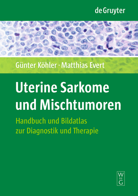 Uterine Sarkome und Mischtumoren - Günter Köhler, Matthias Evert