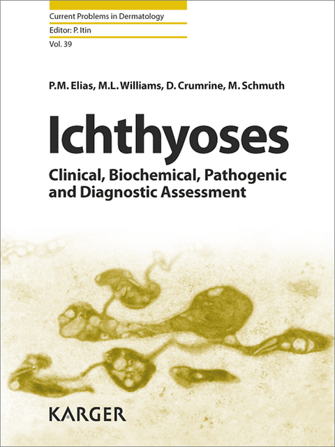 Ichthyoses - 