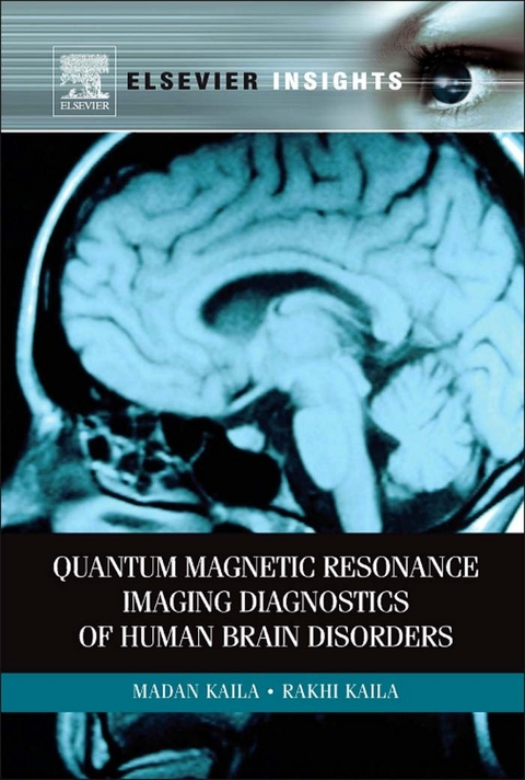 Quantum Magnetic Resonance Imaging Diagnostics of Human Brain Disorders -  Madan M Kaila,  Rakhi Kaila