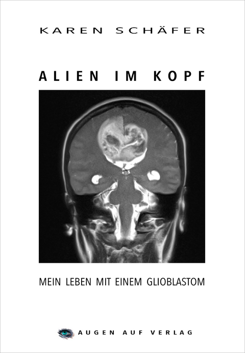 Alien im Kopf - Karen Schäfer