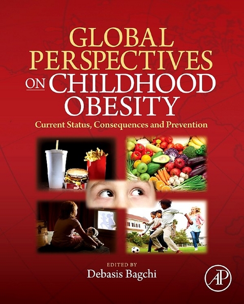 Global Perspectives on Childhood Obesity - 