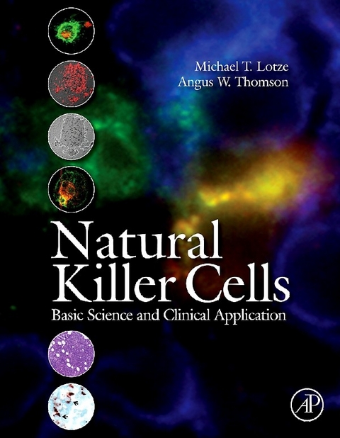 Natural Killer Cells - 