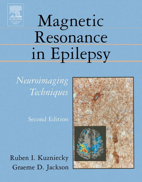 Magnetic Resonance in Epilepsy -  Graeme D. Jackson,  Ruben Kuzniecky