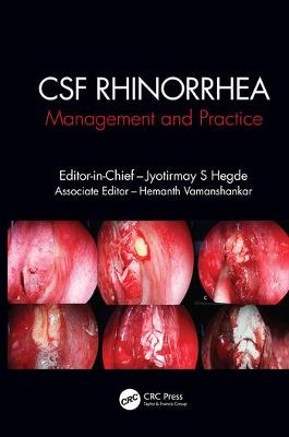 CSF Rhinorrhoea - 