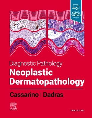 Diagnostic Pathology: Neoplastic Dermatopathology - David S. Cassarino