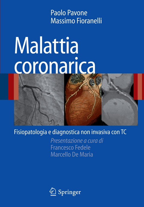 Malattia coronarica - Paolo Pavone, Massimo Fioranelli