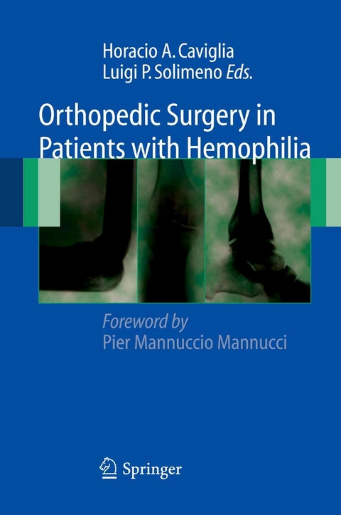 Orthopedic Surgery in Patients with Hemophilia - 