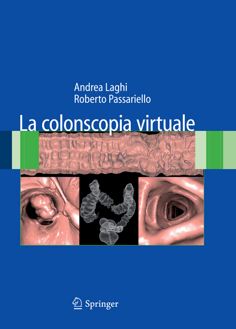 La colonscopia virtuale - Andrea Laghi, Roberto Passariello