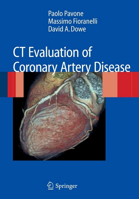 CT Evaluation of Coronary Artery Disease - Paolo Pavone, Massimo Fioranelli, David A. Dowe