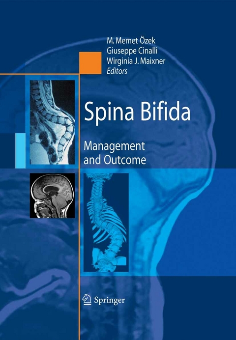 Spina Bifida - 