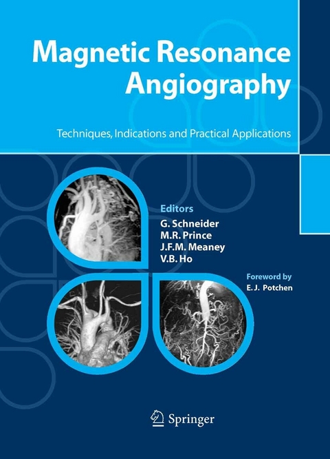 Magnetic Resonance Angiography - 