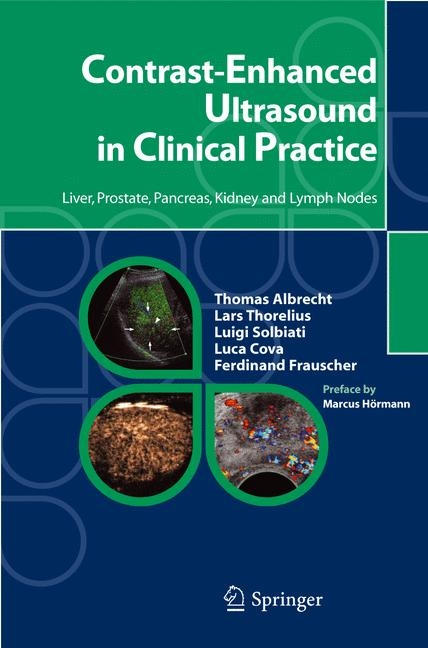 Contrast-Enhanced Ultrasound in Clinical Practice - Thomas Albrecht, Lars Thorelius, Luigi Solbiati, Luca Cova, Ferdinand Frauscher