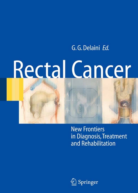 Rectal Cancer - 