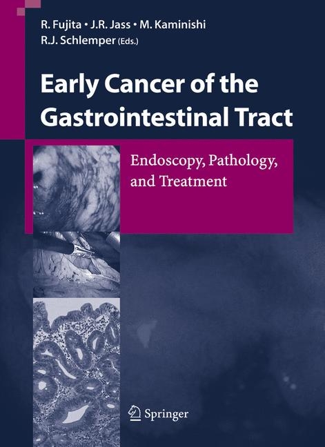 Early Cancer of the Gastrointestinal Tract - 